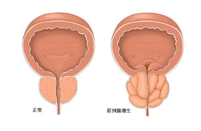 兩性健康 | 對于女性來說，最怕男人得什么??？(圖1)